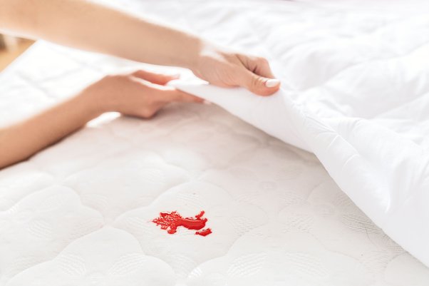 How To Get Blood Out Of Sheets In 6 Easy Steps